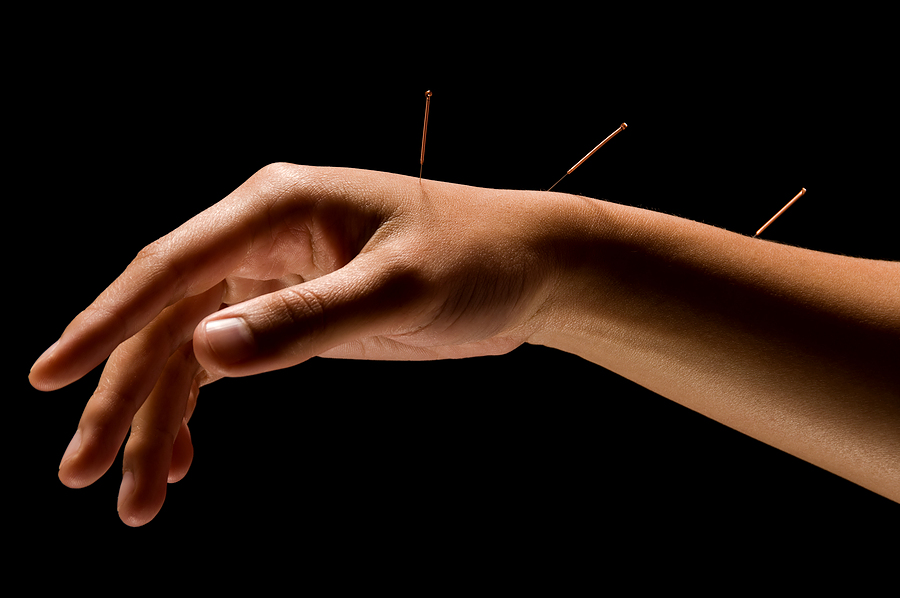 Acupuncture Hand